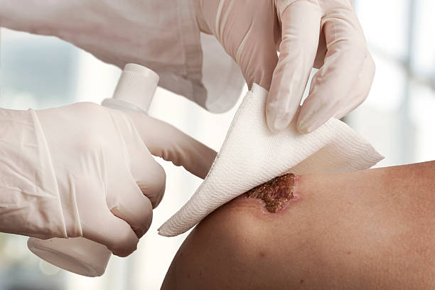 wound care